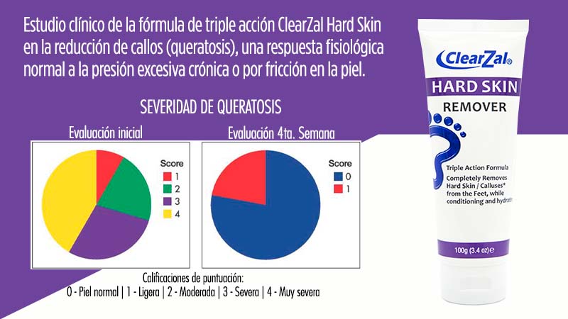 ClearZal® Hard Skin Remover